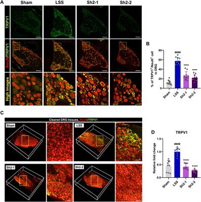 Repeated epidural delivery of Shinbaro2: effects on neural recovery, inflammation, and pain modulation in a rat model of lumbar spinal stenosis